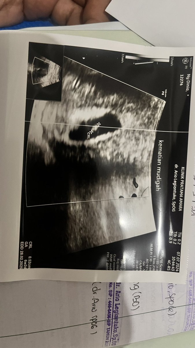 diniachyutm's tweet photo. Sebentar lagi kita berpisah ya❤️huhu baru aku merasakan rasanya jatuh cinta secinta ini🥹 https://t.co/Nx0PvlV2sw