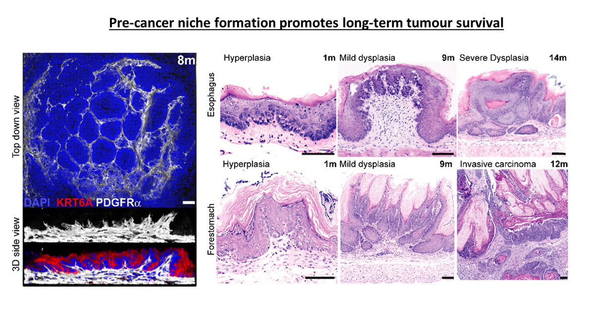5/8-This leads to the formation of a fibrotic pre-cancer tumour niche that, in turn, feeds back on the epithelium promoting the growth and long-term survival of nascent tumours.