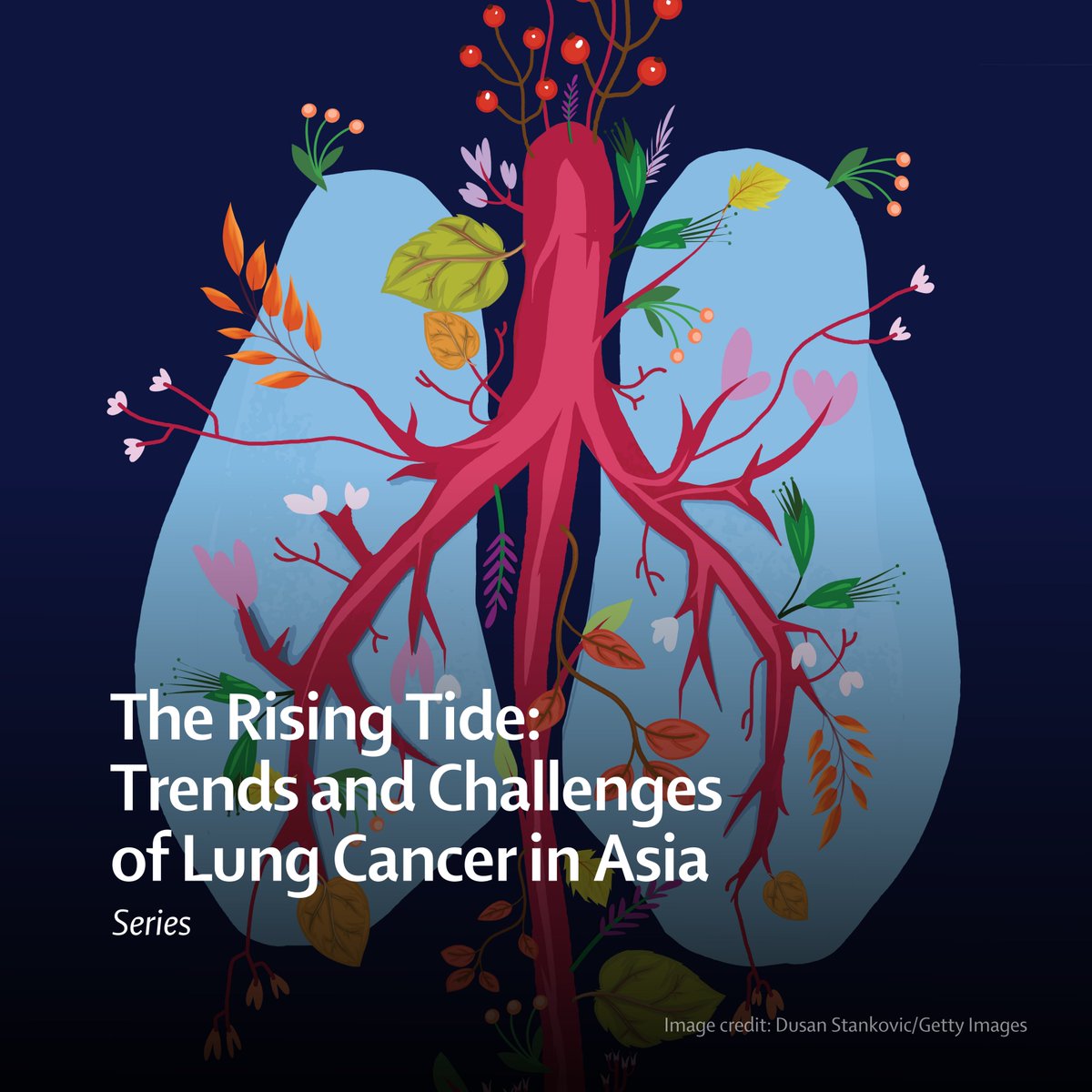 The Lancet (@thelancet) on Twitter photo Lung cancer is a significant public health issue in Asia, representing one of the leading causes of cancer-related mortality.
A new Series from <a href="/eClinicalMed/">eClinicalMedicine – The Lancet Discovery Science</a>, <a href="/LancetRH_WPac/">The Lancet Reg Health-West Pacific</a>, and <a href="/LancetRH_SEAsia/">The Lancet Reg Health-Southeast Asia</a> explores the trends and challenges of lung cancer in Asia: hubs.li/Q02FM_DQ0 Lung cancer is a significant public health issue in Asia, representing one of the leading causes of cancer-related mortality.
A new Series from <a href="/eClinicalMed/">eClinicalMedicine – The Lancet Discovery Science</a>, <a href="/LancetRH_WPac/">The Lancet Reg Health-West Pacific</a>, and <a href="/LancetRH_SEAsia/">The Lancet Reg Health-Southeast Asia</a> explores the trends and challenges of lung cancer in Asia: hubs.li/Q02FM_DQ0