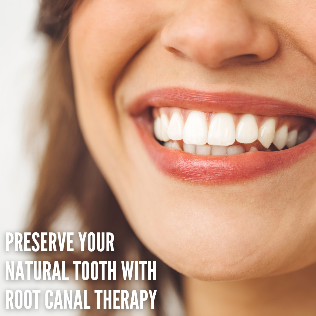 bureau_george's tweet photo. Our expert root canal treatments at George Bureau can save your tooth and alleviate pain. Trust our experienced team.
📞 Call us now: 01473 257414
#RootCanal #ToothPreservation #GeorgeBureau #Endodontics #PainRelief https://t.co/L4tBl40peQ