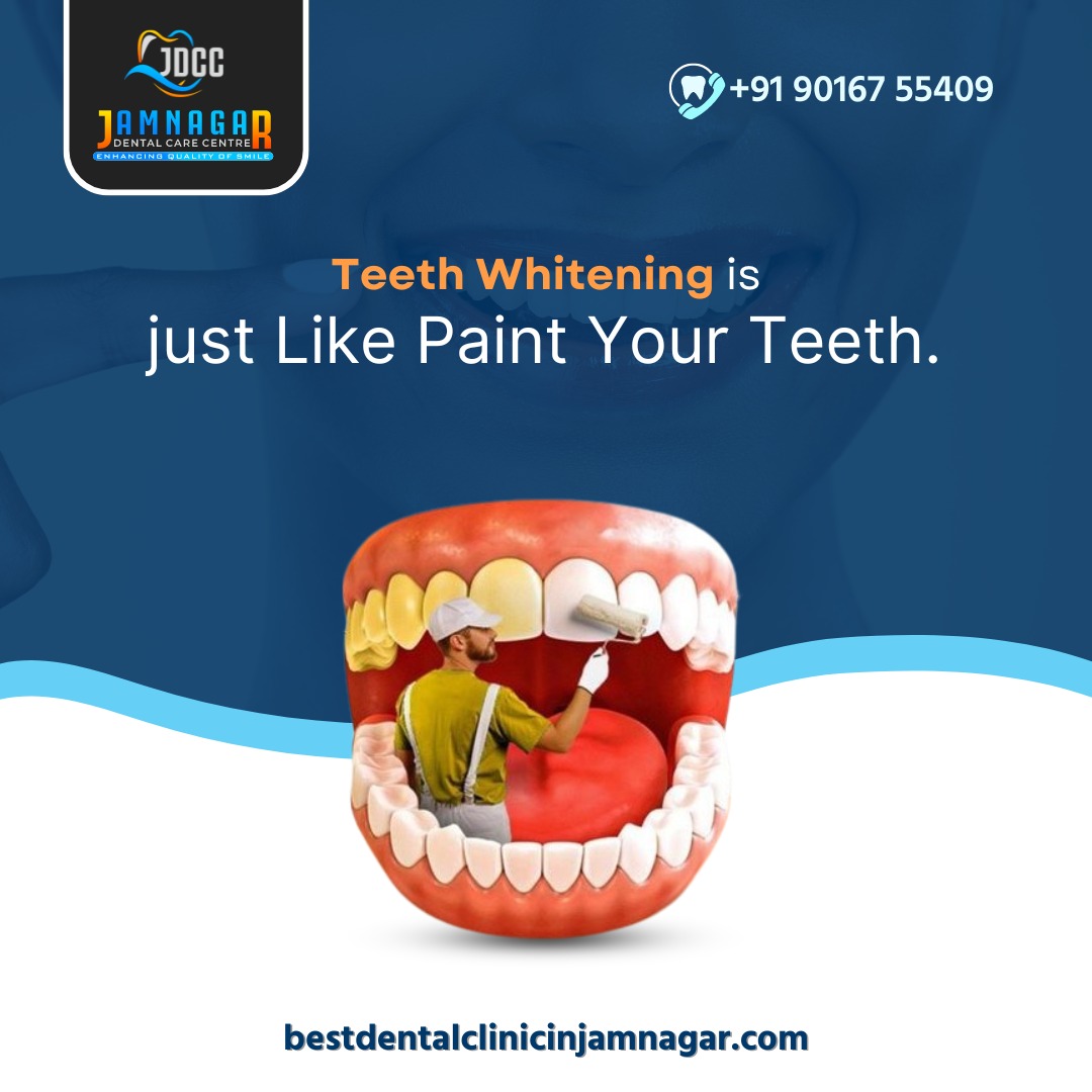 Teeth Whitening Makes Your Smile Even More Bright <a href="/jdccjamnagar/">Jamnagar dental care center</a> TO ENSURE GOOD DENTAL HEALTH.

+91 9016755409
bestdentalclinicinjamnagar.com

#smilemakeover #smile #dentist #dentistry #veneers  #teethwhiteningtreatment #teethwhiteningspecialist