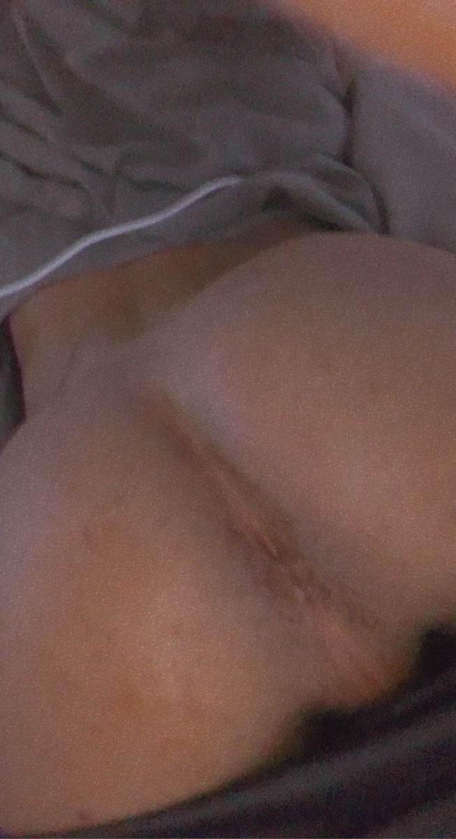 Who wants to see more content with others 

Rt for more 😉 

#hung #bubblebut #ass #horny #gay #gayvers #uk #ukchav #porn