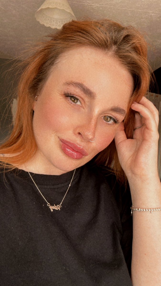 devxnrxden's tweet photo. Had my lips done yesterday🥰 https://t.co/8XsMckGN0X