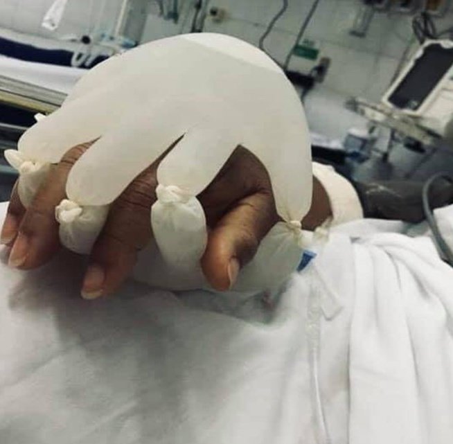 creepydotorg's tweet image. 22. Using gloves with warm water to comfort intubated COVID patients.