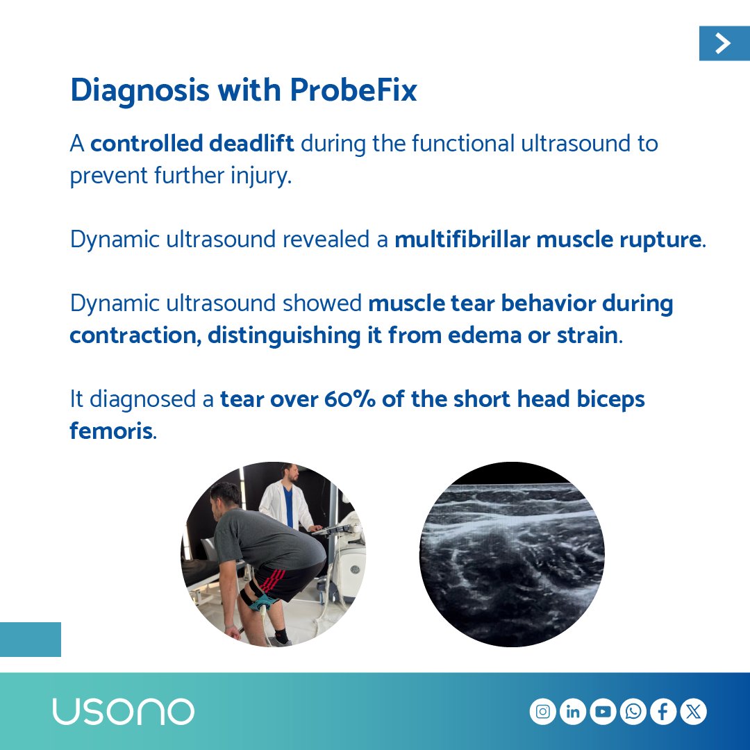 Usono tweet media