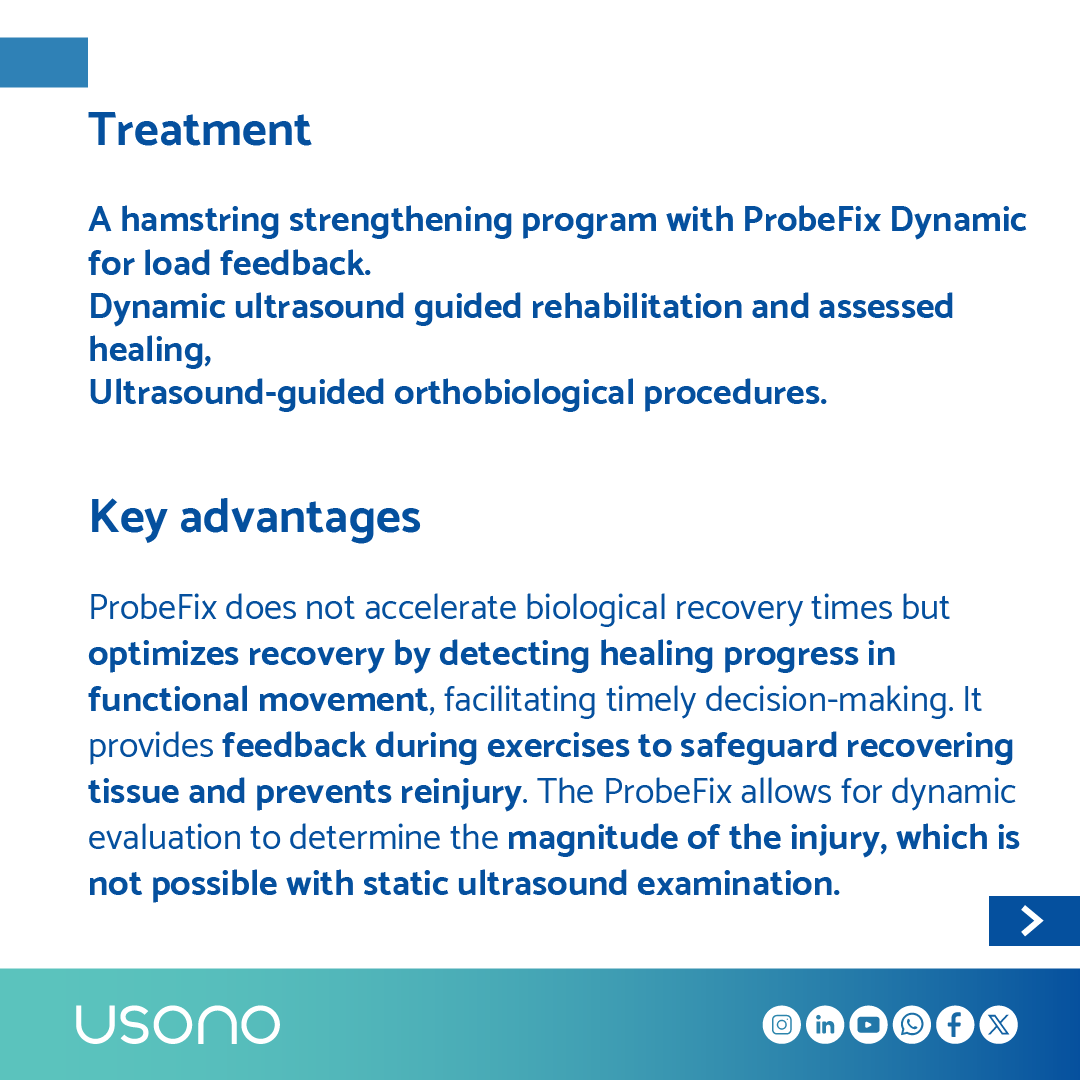 🆕 Clinical case study using ProbeFix Dynamic: 𝗔𝗻𝗮𝗹𝘆𝘀𝗶𝘀 𝗼𝗳 𝗺𝘂𝘀𝗰𝗹𝗲 𝗳𝘂𝗻𝗰𝘁𝗶𝗼𝗻 𝗼𝗳 𝗮 𝗳𝗲𝗺𝗼𝗿𝗮𝗹 𝗯𝗶𝗰𝗲𝗽 𝘁𝗲𝗮𝗿, 𝗯𝘆 𝗱𝘆𝗻𝗮𝗺𝗶𝗰 𝘂𝗹𝘁𝗿𝗮𝘀𝗼𝘂𝗻𝗱 𝘁𝗲𝘀𝘁 by Dr. Jorge Ojeda Barrientos from <a href="/ClubNecaxaEN/">ClubNecaxa (English) ⚡️🇺🇲</a> 🇲🇽🌎⚽️🥊 usono.com/studies/analys…