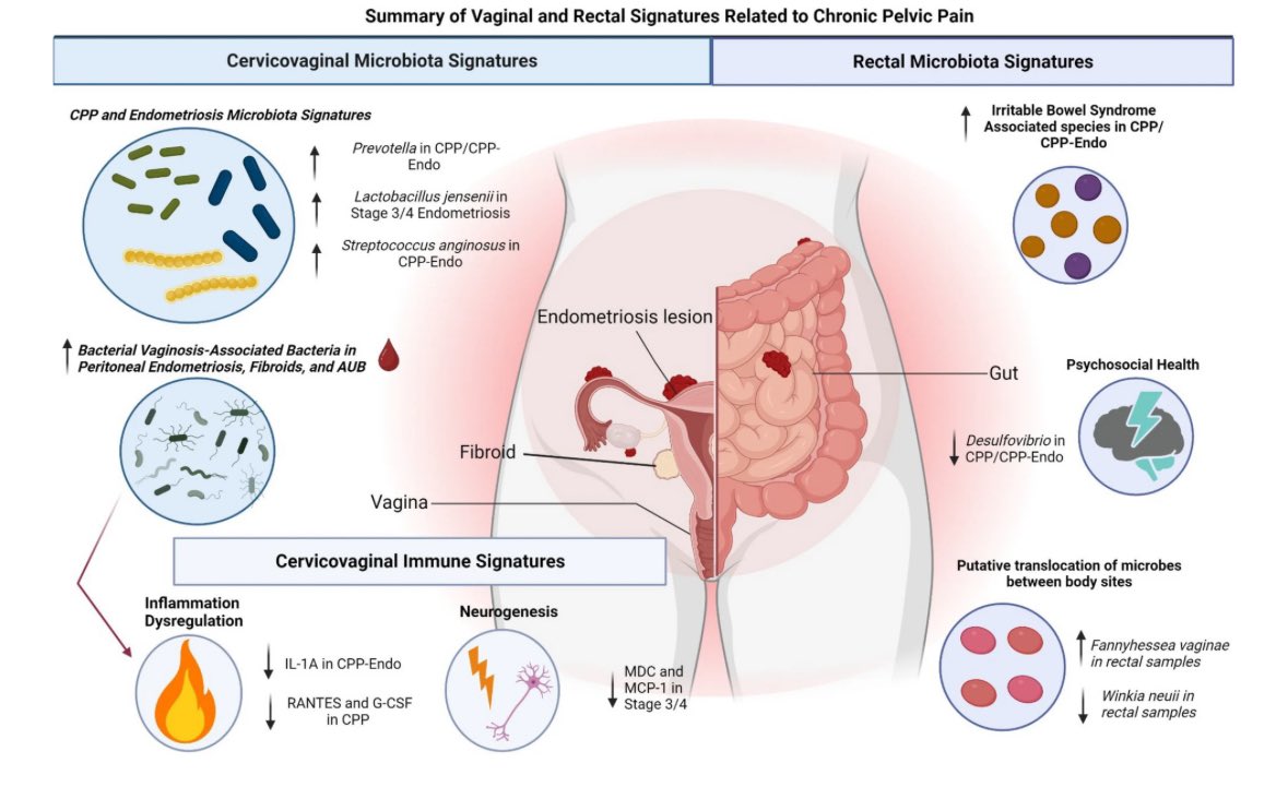 Melissa M. Herbst-Kralovetz, PhD (@herbstkralovetz) on Twitter photo 🚀 Excited to announce our study on chronic pelvic pain (CPP) and #endometriosis led by Drs. <a href="/ScientistNicole/">Nicole Renea Jimenez</a> & <a href="/TaylorJNorton/">Taylor Norton, MD (he/him/his)</a>!
Highlights:
- IBS-associated bacteria
- Vaginal microbiome changes
- Distinct immune profiles
Thanks to team & participants!
👉🏼: url.usb.m.mimecastprotect.com/s/7FVnCVJz4qf9… 🚀 Excited to announce our study on chronic pelvic pain (CPP) and #endometriosis led by Drs. <a href="/ScientistNicole/">Nicole Renea Jimenez</a> & <a href="/TaylorJNorton/">Taylor Norton, MD (he/him/his)</a>!
Highlights:
- IBS-associated bacteria
- Vaginal microbiome changes
- Distinct immune profiles
Thanks to team & participants!
👉🏼: url.usb.m.mimecastprotect.com/s/7FVnCVJz4qf9…