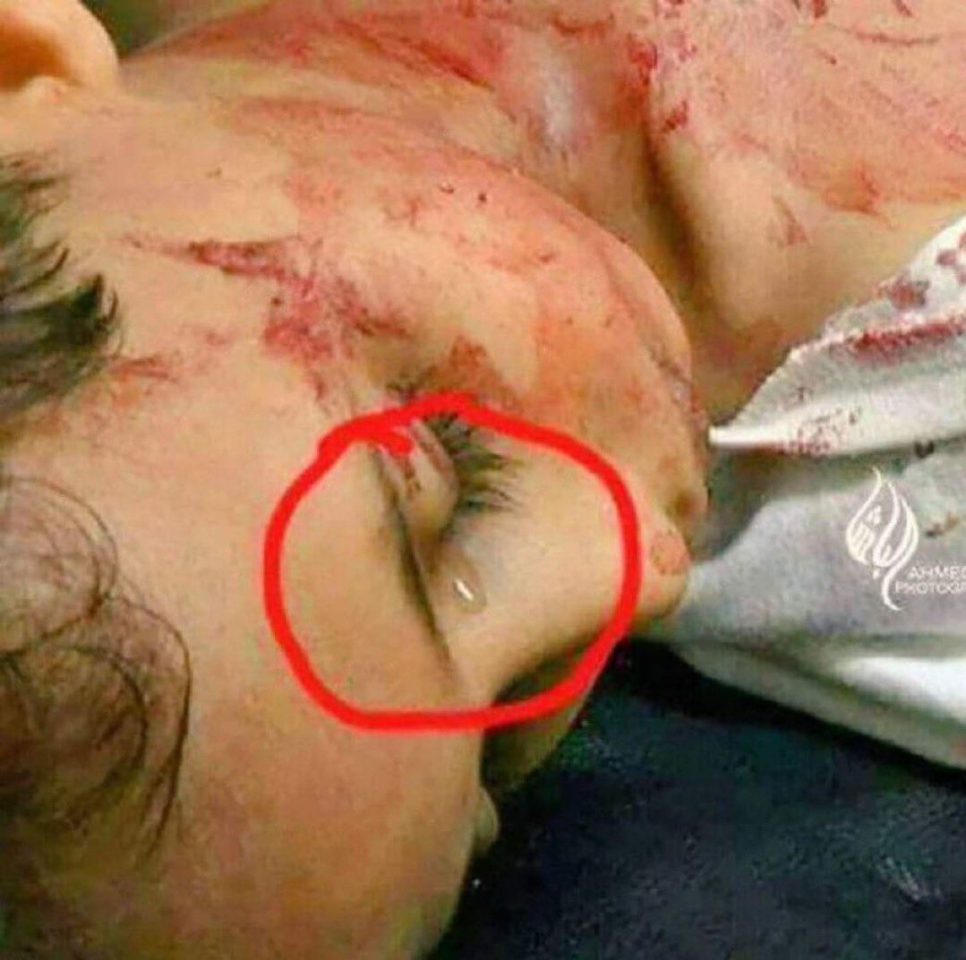 ذهب شهيدًا وما زالت في عينيه الدموع، ذهب شهيدًا حتّى قبل أن يجفّ دمعه ..

حسبنا الله ونعم الوكيل