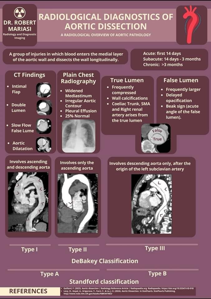 🔴🧪 Radiological Diagnostics of Aortic Dissection ✍️🔹

 #Meded #medx  #medtwitterWhat #MedTwitter #CardioEd #medx #medEd #CardioTwitter #cardiotwitter #MedX  #cardiology #cardiotwiteros #FOAMed #medicine #cardiox #medical #cardiovascular #paramediclife