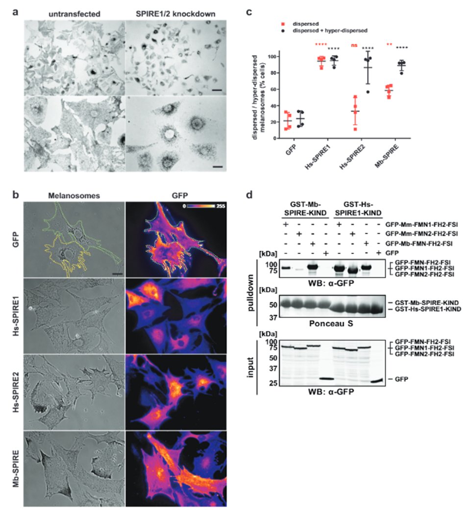 Our latest: An actin-myosin driven exocytic transport mechanism preceding animals? Nice collaborative work led by Eugen Kerkhoff including beautiful choanoflagellate overexpression studies by <a href="/aishwarya12ravi/">Aishwarya Ravi</a> out now in <a href="/CommsBio/">Communications Biology</a>. <a href="/MSarsCentre/">Michael Sars Centre</a> <a href="/UiBmatnat/">RealfagUiB</a> nature.com/articles/s4200…