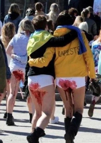 Slava_Za_Rostov's tweet photo. Как отличить украинцев от русских:
1. У них не сворачивается кровь, она всегда алая 
2. Вместо того, чтобы идти в больницу, они идут к фотографам https://t.co/uGpmreIfGj