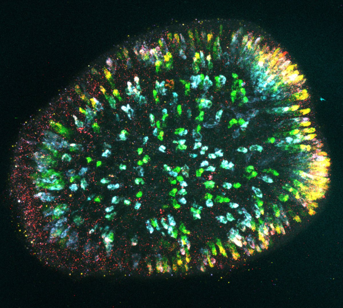 Anna Klompen, PhD (@gelatinoussting) on Twitter photo I wonāt be able to share in person <a href="/cnidofest/">Cnidofest</a>, but Iāll be talking more about this amazing image and other beautiful ones like it virtually next week! Itās been a major team effort by <a href="/Gibson_Lab/">Gibson Lab</a> <a href="/ScienceStowers/">Stowers Institute</a> <a href="/StowersMicro/">Stowers Institute Electron and Light Microscopy</a>!
#ToxinTuesday #StunningStella I wonāt be able to share in person <a href="/cnidofest/">Cnidofest</a>, but Iāll be talking more about this amazing image and other beautiful ones like it virtually next week! Itās been a major team effort by <a href="/Gibson_Lab/">Gibson Lab</a> <a href="/ScienceStowers/">Stowers Institute</a> <a href="/StowersMicro/">Stowers Institute Electron and Light Microscopy</a>!
#ToxinTuesday #StunningStella