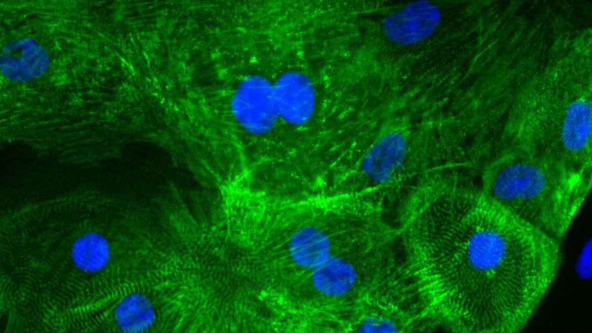 The ISS National Lab is excited to be at #ISSCR2024! Join us tomorrow at 12:00 pm CEST for an Innovation Showcase with a panel of experts to explore the groundbreaking intersection of #stemcell research and low Earth orbit.
