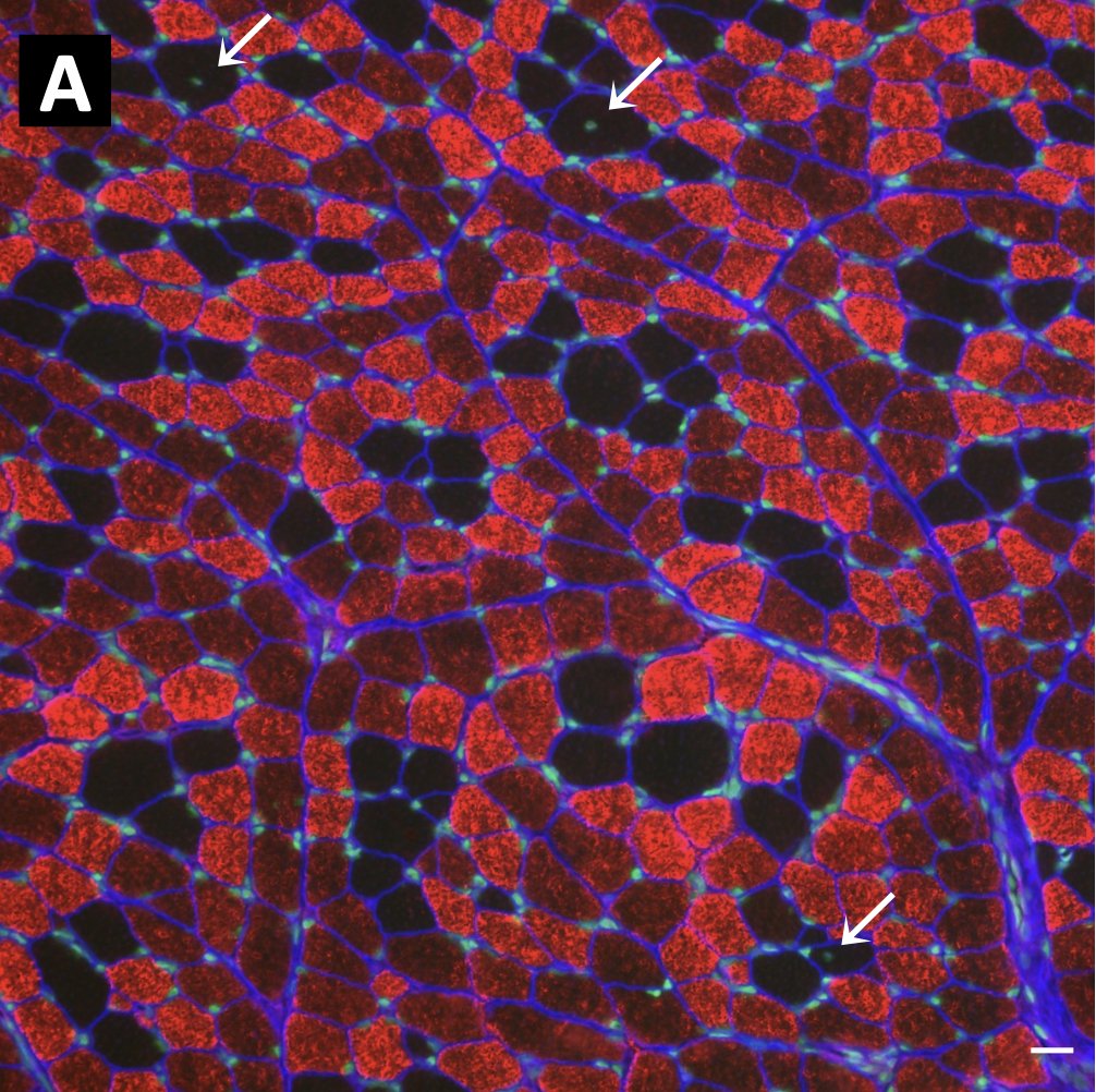 🤩New publication🤩
What started as Malene Tangbjerg's bachelor thesis developed into a great team effort <a href="/ann_damgaard/">Ann Damgaard</a> <a href="/AndersKarlsen19/">Anders Karlsen</a> <a href="/AbigailMackey1/">Abigail Mackey</a> 
🐷💪🔬
<a href="/ThePhySoc/">The Physiological Society</a> <a href="/ExpPhysiol/">Experimental Physiology</a> 
IGF-1 in preterm piglets does not affect muscle or tendon
physoc.onlinelibrary.wiley.com/doi/10.1113/EP…