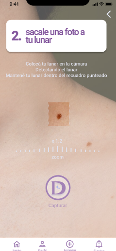 Dermasync1's tweet photo. The main idea is an app where each person can have control over their moles and an AI warns you if they may be malignant, and thus be able to prevent skin cancer.
The app name is going to be Dermasync! 
@_buildspace #nightsandweekends https://t.co/Zr8tStnTPj