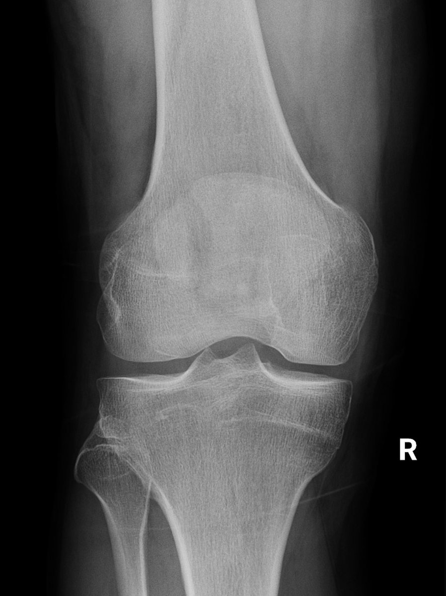 Murali K Sayana 🩺🔪🍽🍷📸🖼 tweet media