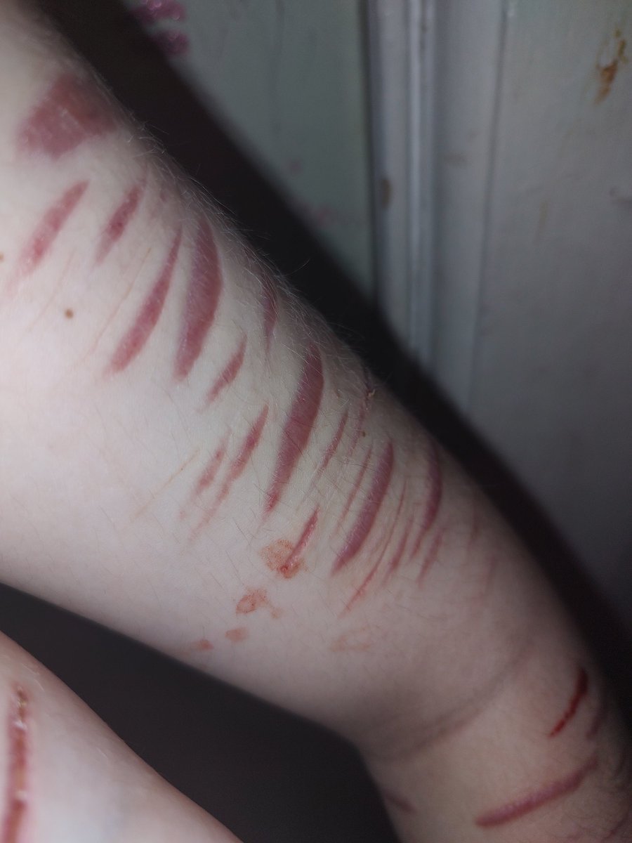 Asmo_Shtwt's tweet photo. #Shtwt Am I scarspo? (⁠ ⁠╹⁠▽⁠╹⁠ ⁠) https://t.co/HrhmuTyTSF