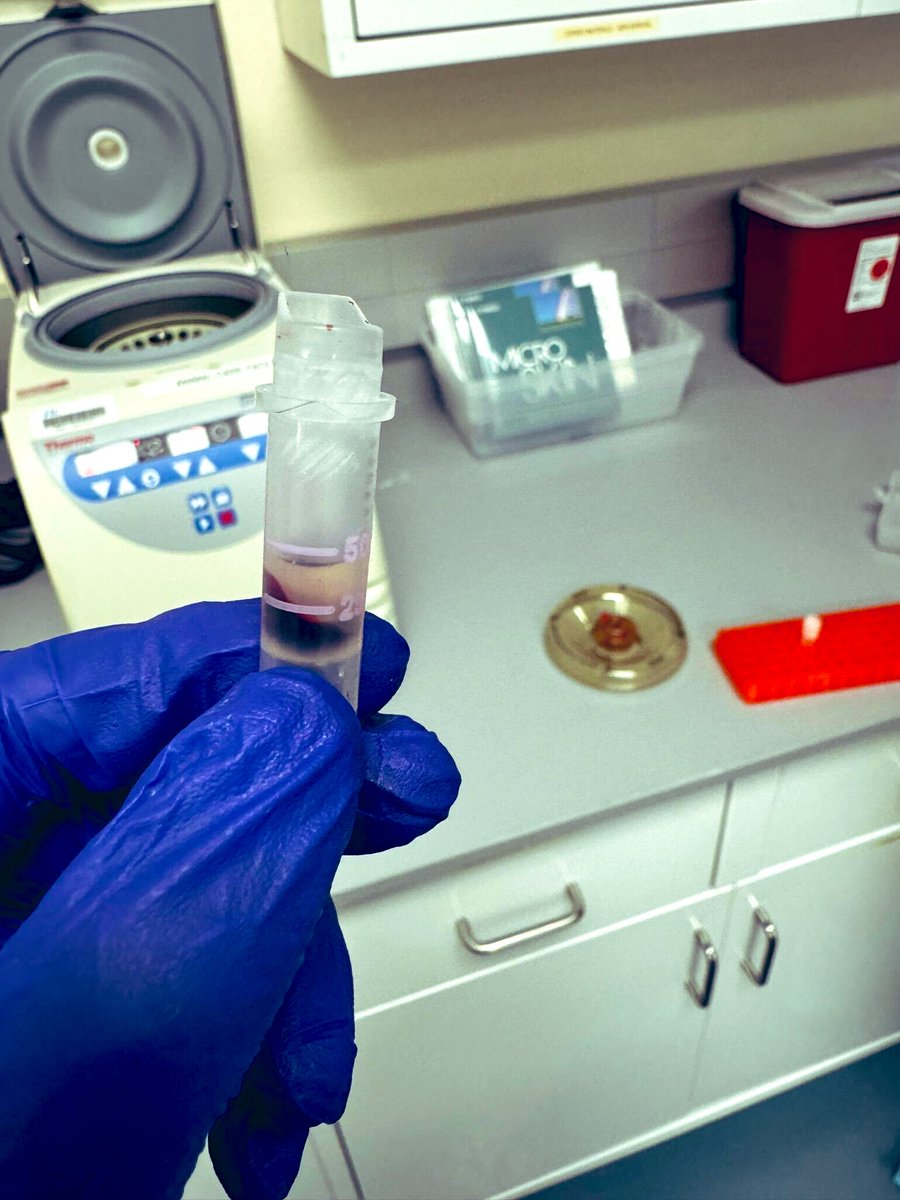 OleksiiShandra's tweet photo. New research milestone unlocked! Sometimes as a #NewPI, stepping back is all it takes. Our talented PhD students at #ShandraLab (@AdilArman08 and @Pritom_Saha11) have mastered blood collection and plasma isolation techniques in mice, a crucial step for our DoD-funded project on traumatic brain injuries and epilepsy. Did I also mention that they now successfully do all the EEG surgeries and collect continuous data? As a #NewPI, I couldnβt be prouder of our teamβs dedication, resourcefulness and progress this summer. #TeamSuccess #NeuroResearch #ProudPI