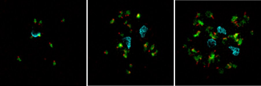 Emma McHugh (@emma_mchuge) on Twitter photo A #maurersclefts IFA just for fun! REX1 (green) and MAHRP2 tethers (red) in a ring, mid troph and late troph. Imaged on the Elyra Lattice SIM 😍with <a href="/lkhuynh_/">Long Huynh</a> A #maurersclefts IFA just for fun! REX1 (green) and MAHRP2 tethers (red) in a ring, mid troph and late troph. Imaged on the Elyra Lattice SIM 😍with <a href="/lkhuynh_/">Long Huynh</a>