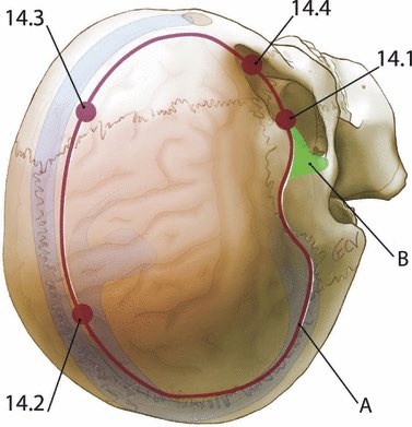 Afgneurosurgeon's tweet photo. #Subdural #Hematoma
In patients presenting with worst clinical status, outcomes are poor regardless of surgical method. Older age and lower GCS score are independently associated with greater mortality risk of patients undergoing decompressive Craniotomy https://t.co/IPSGfpZKoZ