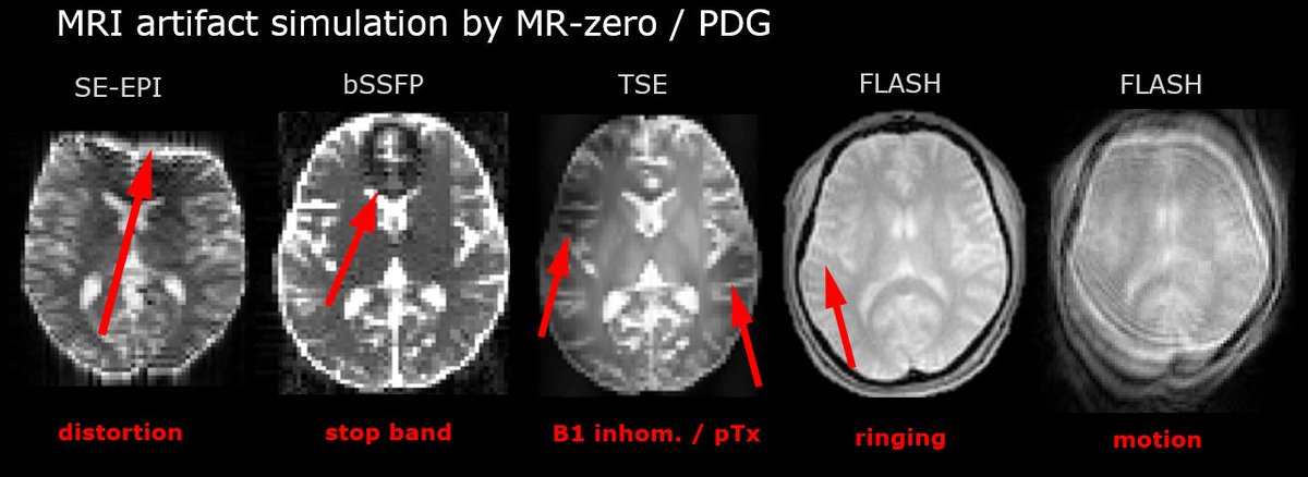 altustro's tweet photo. Nice MR images are actually easier to simulate than not-so-nice ones. MR-zero with Phase Distribution Graphs simulates typical MRI artifacts quite well, which helps to study and mitigate them.
https://t.co/K00md0jHJf

PDG: https://t.co/t2X79yFRXE https://t.co/s5VovOwTSg