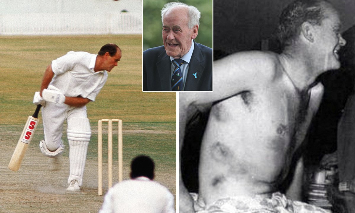 ABsay_ek's tweet photo. 75 minutes of Hell

On This day; in 1976;It was the 3rd day of Old Trafford Test & West Indies were dominating when they set a target of 552...
England had to survive for 75 minutes of play which turned out to be indescribably brutal...

England Openers were Brian Close(45 years) & John Edrich(39 Years) against
Andy Robers, Michael Holdin & Wayne Daniel , who showed no mercy, relentlessly targeting the batsmen with bouncers aimed at their heads. All three bowlers were exceptionally fast & unleashed their full force against the two elderly batsmen...
Without helmets & any safety gears,both batters endured numerous body blows but managed to protect their wickets...

Ultimately Umpire Bill Alley had to warn Holding for bowling too many bouncers, much to his surprise, Close asked to him:

"Why did you have to do that?" an agitated Close asked Alley.

"He's bowling too many bouncers," Alley responded, confused.

"Don't you realize the bouncers aren't the issue? It's the ones halfway down that are the problem," Close retorted.

Here to mention that Close was famous  for appearing immune to pain(see the image for his body blows from the red cherry), he would remark to anyone who flinched or rubbed a bruise: "How can the ball hurt you? It's only on you for a second."

Captain Lloyd didn't hold back his bowlers at all...Though, he commented after the match, "Our guys got carried away."

Both openers survived the session & on their way to dressing room, Edrich asked to Close:

"After 70 minutes out there & getting hit all over, do you know how many runs you scored?" Edrich chuckled.

Close admitted he didn't.

"One," laughed Edrich. "I hope it was worth the pain."
