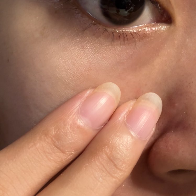 kintanmarc's tweet photo. Ini beberapa cara preventif yg aku lakuin supaya garis halus tuh ga semakin muncul.  Sebelumnya harus tau dulu faktor munculnya finelines tuh kenapa. Kalau aku selain karena keturunan, bisa jd karena faktor kulit yg kering juga.

Makanya pengen glowing tapi muka ngga berminyak. https://t.co/XJWrMNtgta