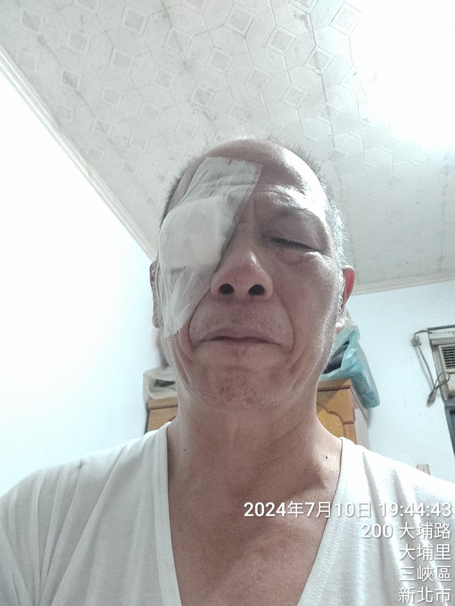 諸位兄弟，今天在工作中，不小心弄傷了眼睛，暫時休息幾天不上線，感恩也很抱歉了