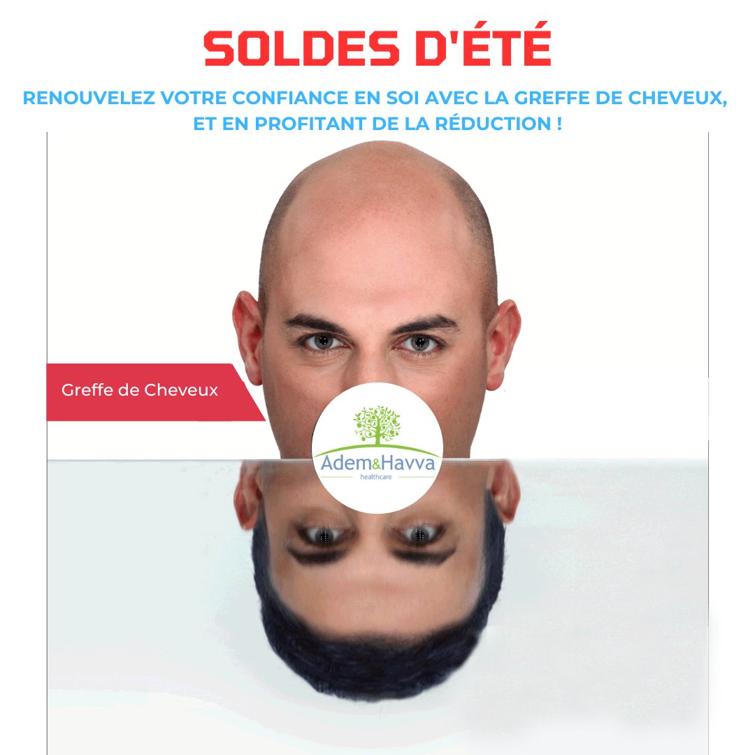 PromotionTrend's tweet photo. Plus de 20000 opérations en greffe de cheveux et chirurgie plastique ont été réalisées sous la supervision d' ADEM et HAVVA 💯🎯
#GreffeDeCheveux #GreffeDeCheveuxIstanbul #Turquie #GreffeDeSourcilsTurquie #GreffeDeCheveuxIstanbulTurquie
https://t.co/VS4RshDHDR https://t.co/J9T21ZVhGj