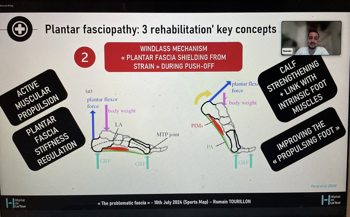 sportsmapnet's tweet image. A fantastic presentation from @r_tourillon on how objectively evaluate and strengthen the foot and plantar fascia.