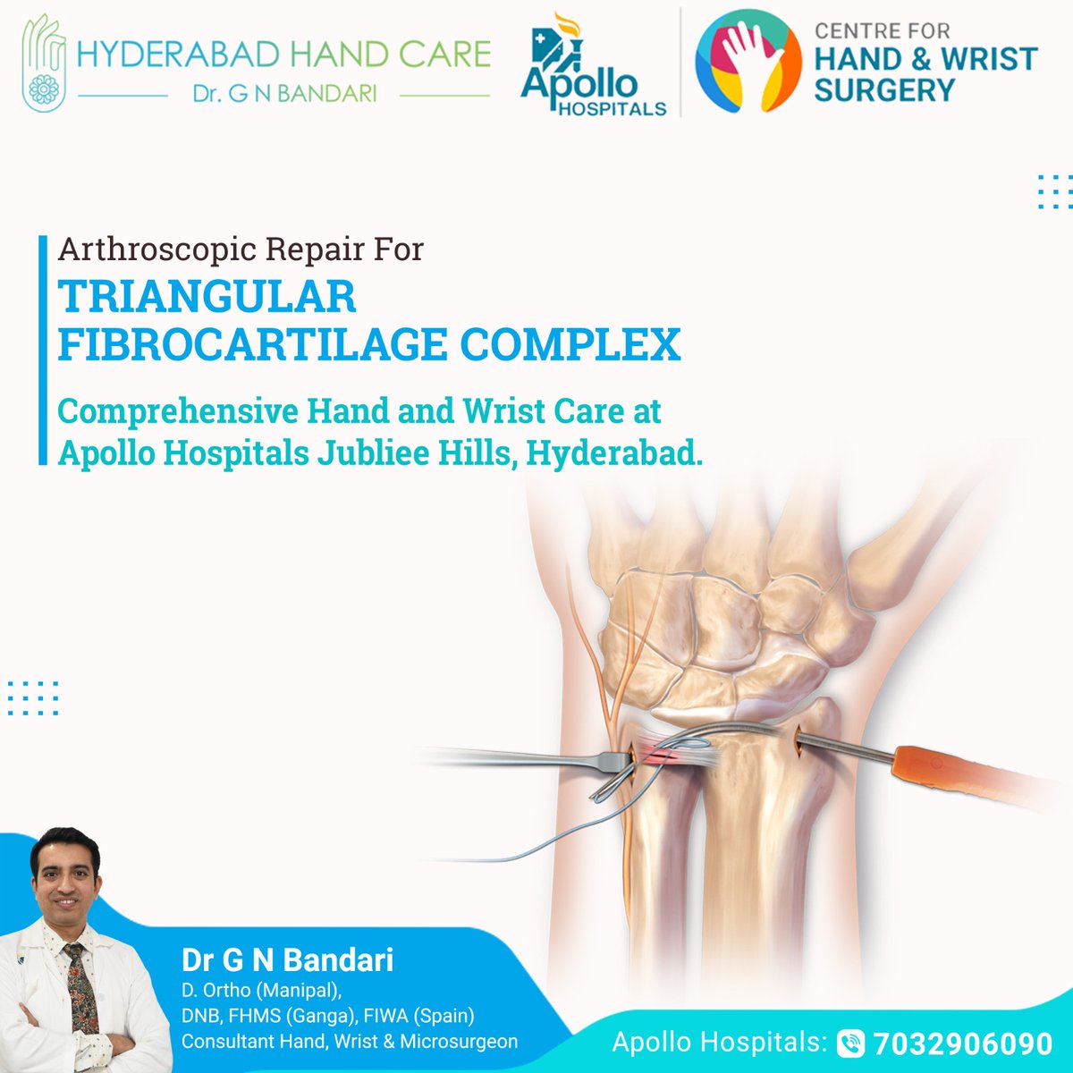 DrGNBandari's tweet image. Discover advanced #arthroscopic repair for #TriangularFibrocartilageComplex.
Expert care for swift recovery and lasting relief.

Dr. GN Bandari
Hand , Wrist &amp;amp; Micro-Surgeon
Book an Appointment
7032906090

For more visit :  
 hyderabadhandcare.com
