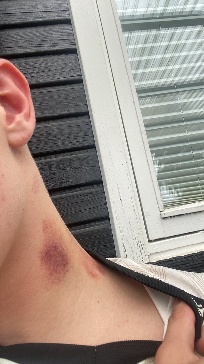 How to get rid of whatever u Call this shit