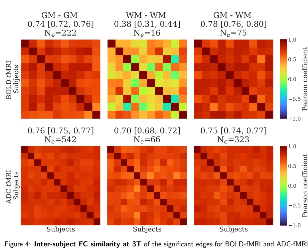 xiaoxiao_mri's tweet photo. Tired of the low SNR of fMRI in white matter？
Here comes another choice, the ADC-fMRI.
https://t.co/FaymGiejI2 https://t.co/syNk12BfZI