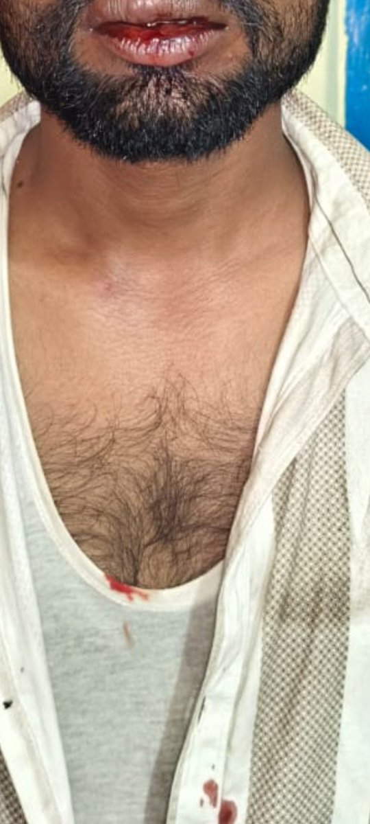 Mohamma16424778's tweet photo. #कानपुर पत्रकार सांसद लोखसभा क्षेत्र में पत्रकार नहीं है सुरक्षित पत्रकार के साथ मारपीट करने वाले दबंग ठाकुर पर कार्यवाही कब सीतामऊ क्षेत्र म किसकी संगरक्षण प्राप्त है दबंग को जो कल रात की घटना का अभी तक cctv नही ला पाई  होनहार पुलिस @Bandaloksabha @Dcpcentralknr @kanpurnagarpol https://t.co/54MwlV4iC6
