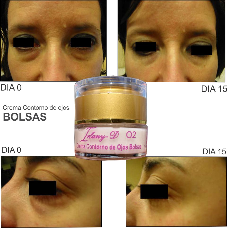 Irlanyd's tweet photo. DESAPARECE ESAS BOLSAS BAJO TUS OJOS con la CREMA DE OJOS BOLSAS con el activo Eyeseryl(R), reduce la hinchazón provocada por la acumulación de agua, desde los primeros 15 días de uso. Está diseñada para humectar y penetrar, absorbiéndose rápidamente. https://t.co/0B86QiEmYQ https://t.co/vk8J5bOX75