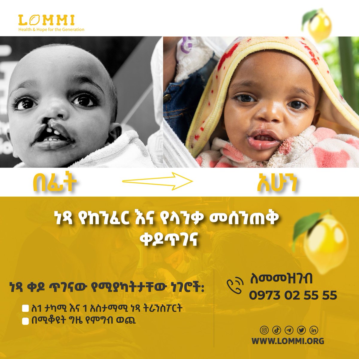 ነፃ የከንፈር እና የላንቃ መሰንጠቅ ማተክከያ ቀዶጥገና ማግኘት ይፈልግሉ ❓❓❓

እንግዲያውስ በሰግለን ዋጂ አጠቃላይ ሆስፒታል በመሰጠት ላይ ይገኛል አገልግሎቱን ለማግኘት አሁኑኑ ደውለው ይመዝገቡ!

ለመመዝገብ☎️☎️☎️ 0973025555 ላይ ይደወሉ!