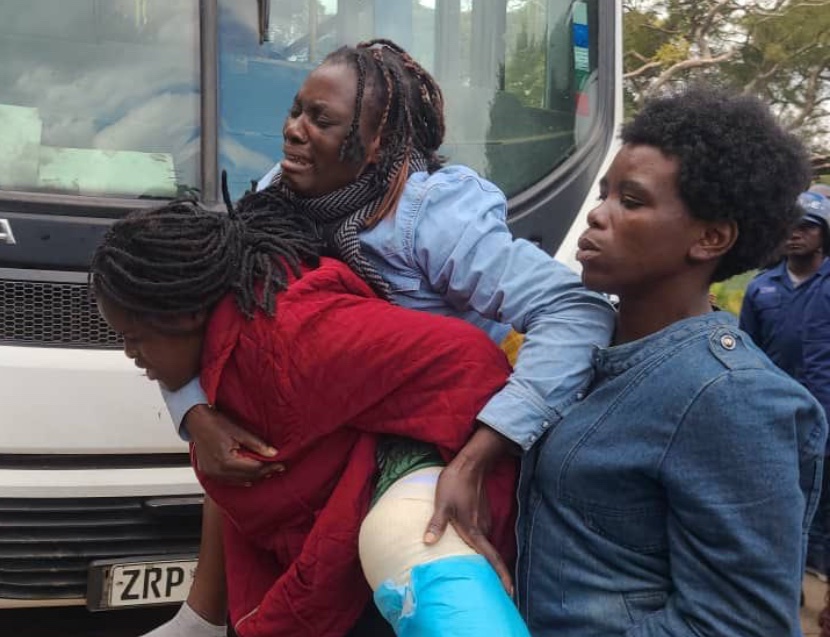 DougColtart's tweet photo. When I say this regime is evil, this is what I mean: Tambudzai Makororo was assaulted by the police during her arrest fracturing her leg. Tragically, her son died while she was in custody and she was denied the right to attend the burial. Why? Why? Why? 😔 #FreeAvondale78 https://t.co/Xyp4yNIgnD