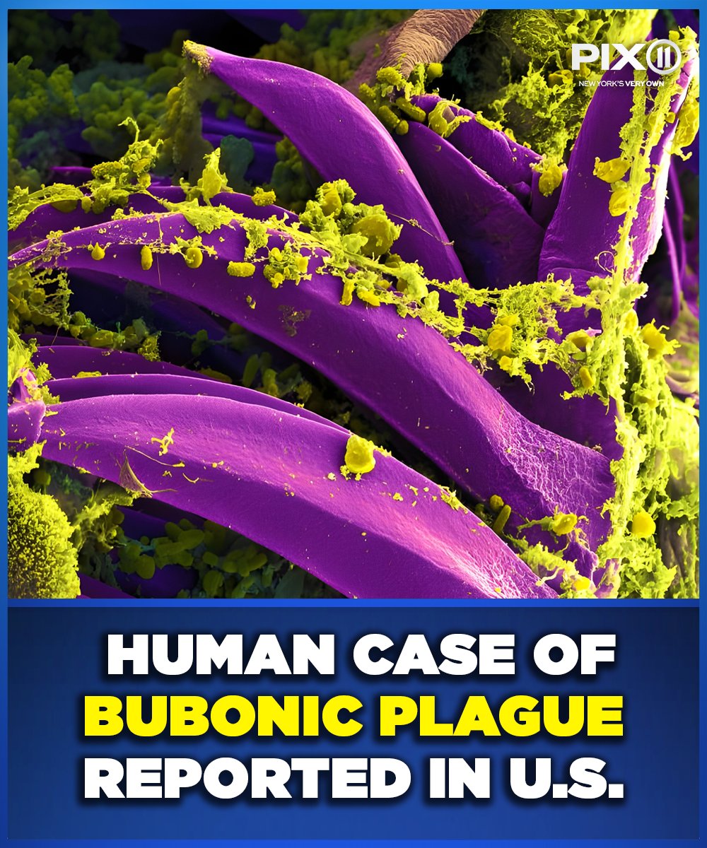PIX11News's tweet photo. A human case of the bubonic plague has been identified in the United States, health officials said.

Here's what to know: https://t.co/wgYUcjoMal https://t.co/B2lfekWhOE