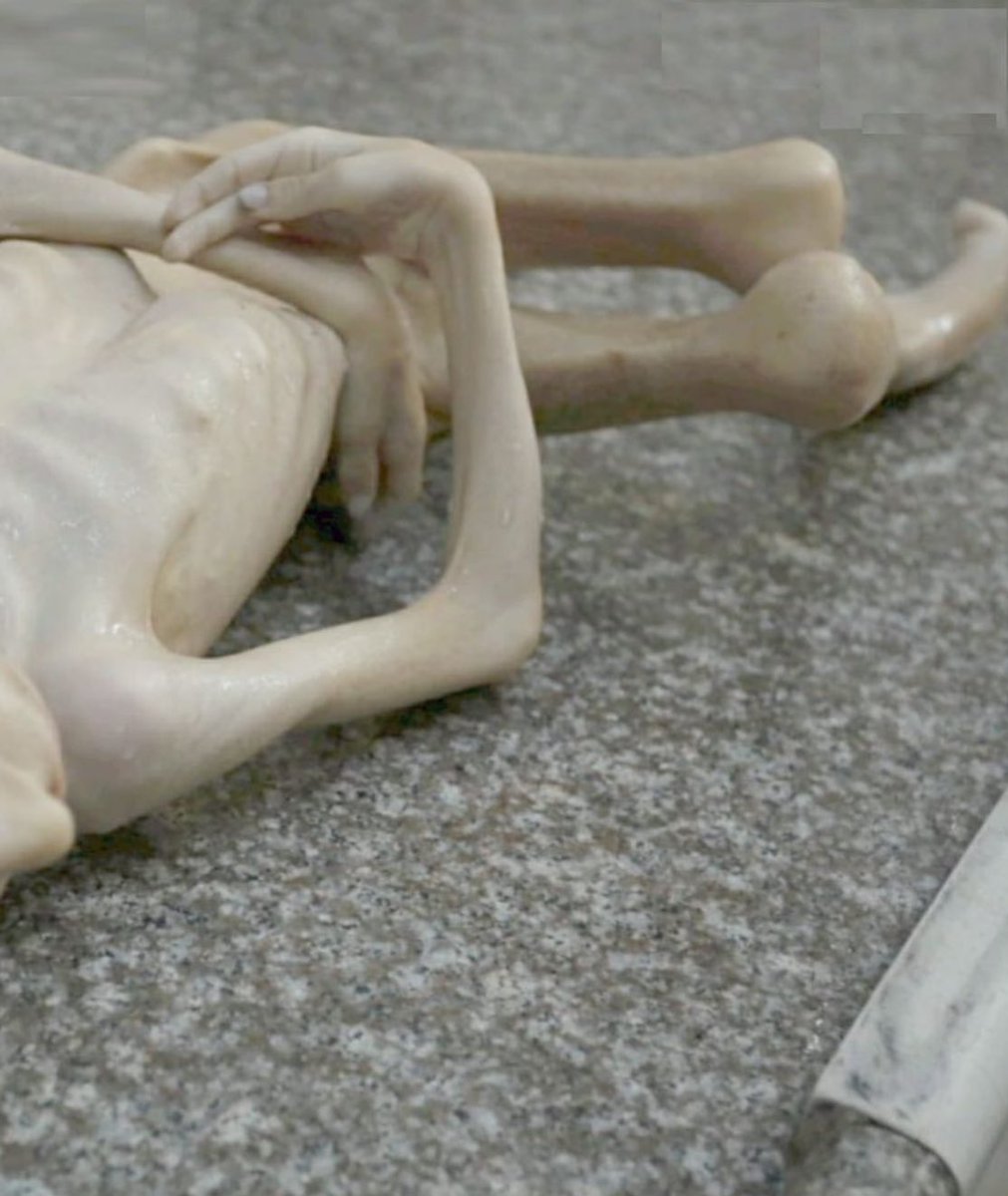 This photo needs to be the front page of every news paper in the world.

Children of Gaza are dying of hunger!