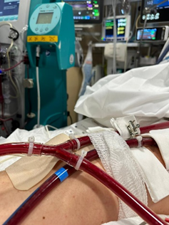 ECMO Barcelona tweet media