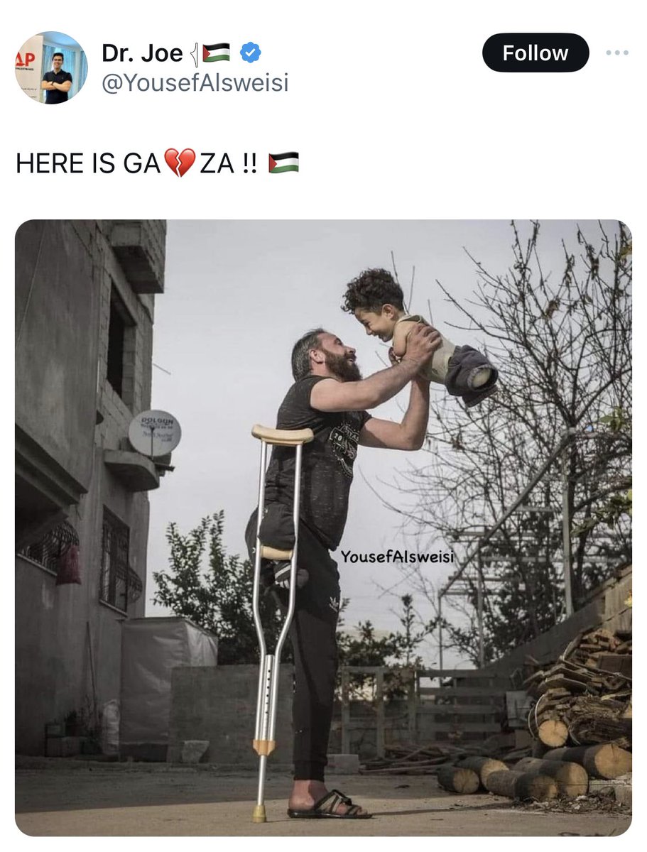 KareemRifai's tweet photo. Mustafa El-Nezzel, a Syrian child born without limbs after his mother was gassed with nerve agent by ASSAD while she was pregnant.

In SYRIA. https://t.co/zOWWQS6E51