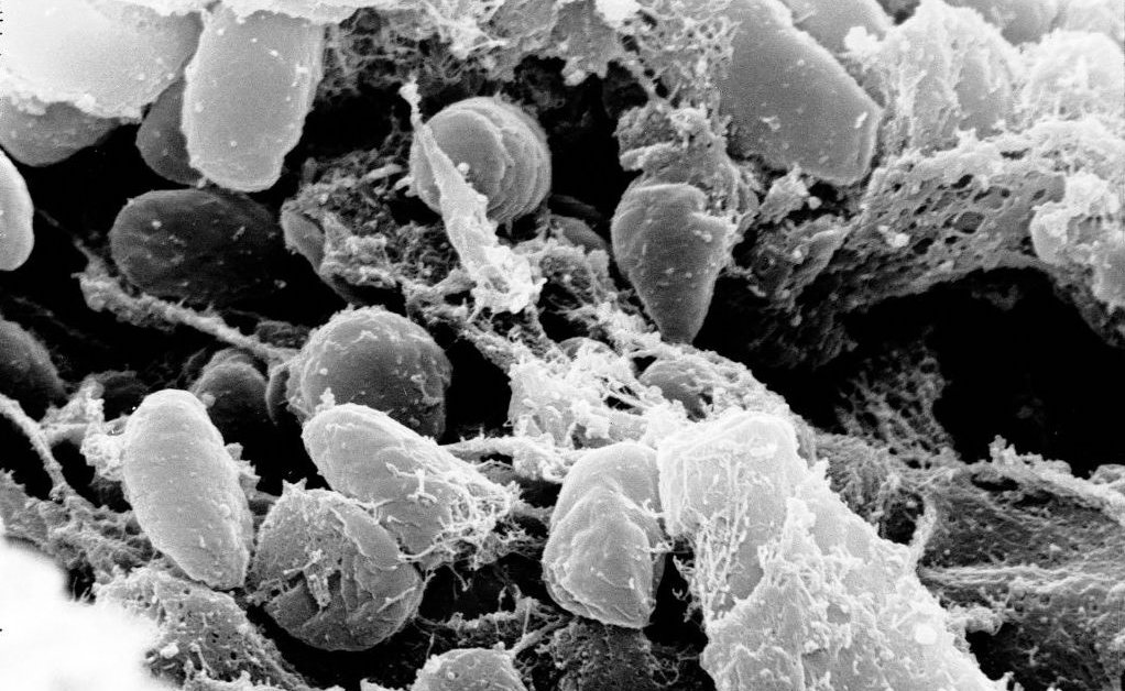 info91810276's tweet photo. Colorado Plague Case Is a Reminder That the ‘Black Death’ Never Really Went Away https://t.co/xlRj8ikXea https://t.co/zZQk28Ov5X