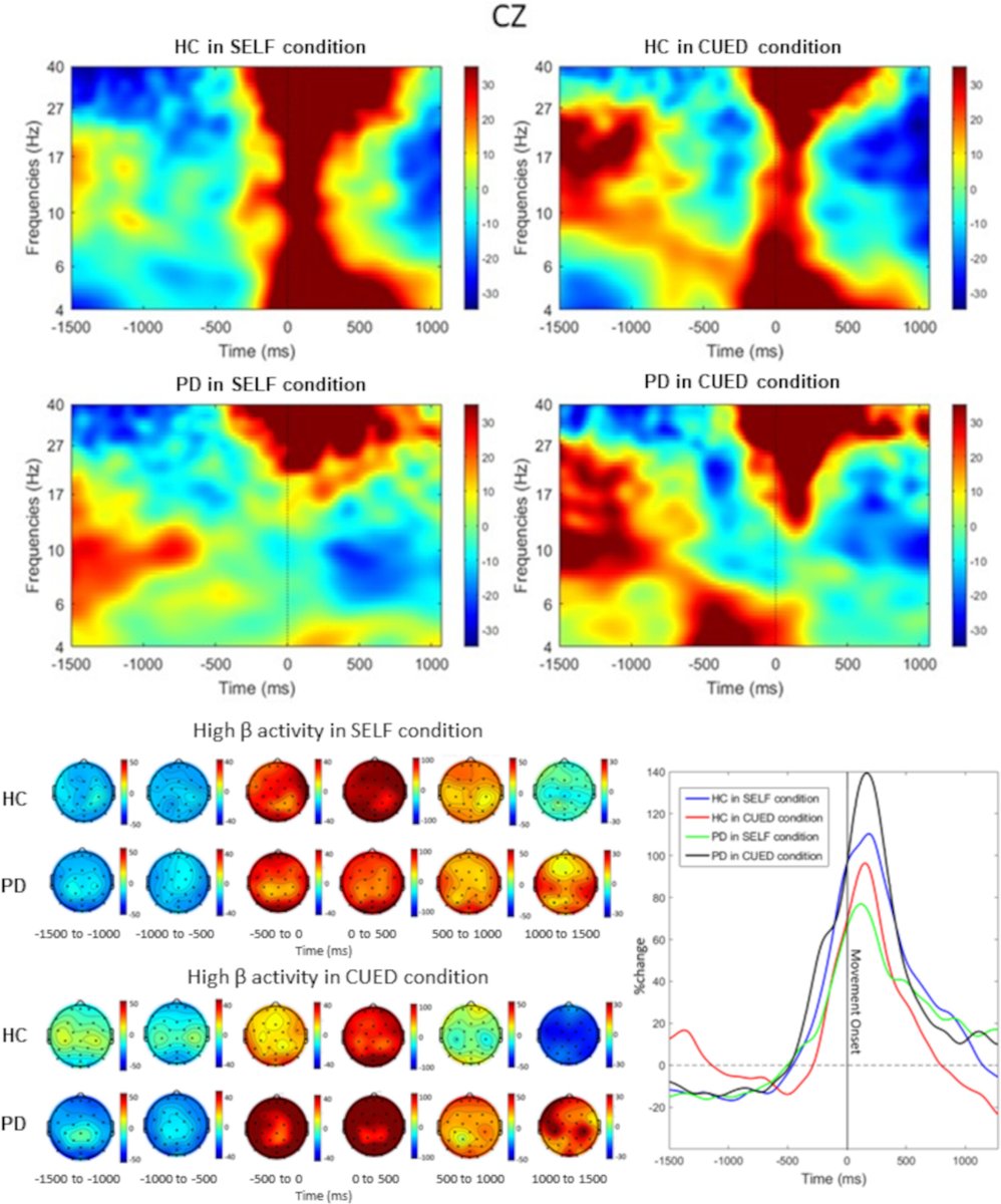 🆕🧠 Latest findings by <a href="/MagdaMustile/">Magda Mustile</a> et al. reveal how external auditory cues aid sit-to-stand movements in PD patients by enhancing motor cortical activation and sensory integration!
🔗 doi.org/10.1002/mds.29…

#ParkinsonsDisease #Neuroscience #Research #EEG #MotorControl