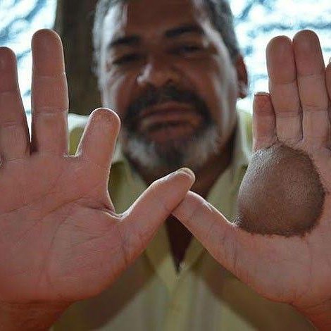 CrimesReais's tweet photo. O acidente radiológico de Goiânia, conhecido como Chernobyl Brasileiro: https://t.co/UKmyWiMZWf