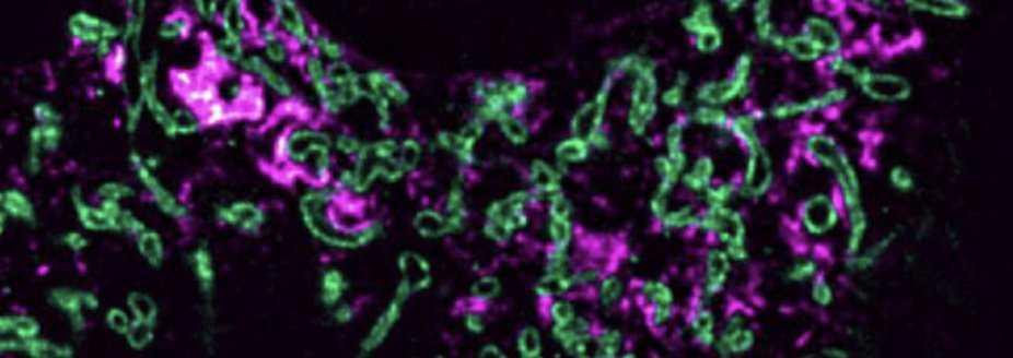 Self-quenched fluorophores attached to short DNA labels increase signal/resolution and reduce background in DNA-PAINT and DNA-STED. We are glad that this follow-up story (more fluors) is now out in JPC. Thank you <a href="/JPhysChem/">The Journal of Physical Chemistry</a> and our great Editor <a href="/JulieBiteenLab/">Julie Biteen</a> 🙏 <a href="/goetheuni/">Goethe-Universität</a>
