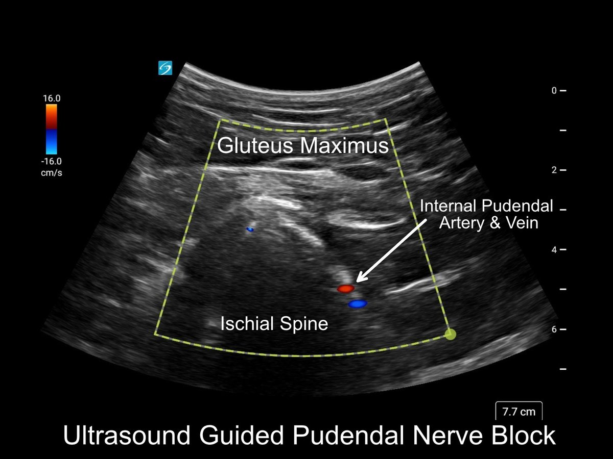 American Society for Post Surgical Pain tweet media