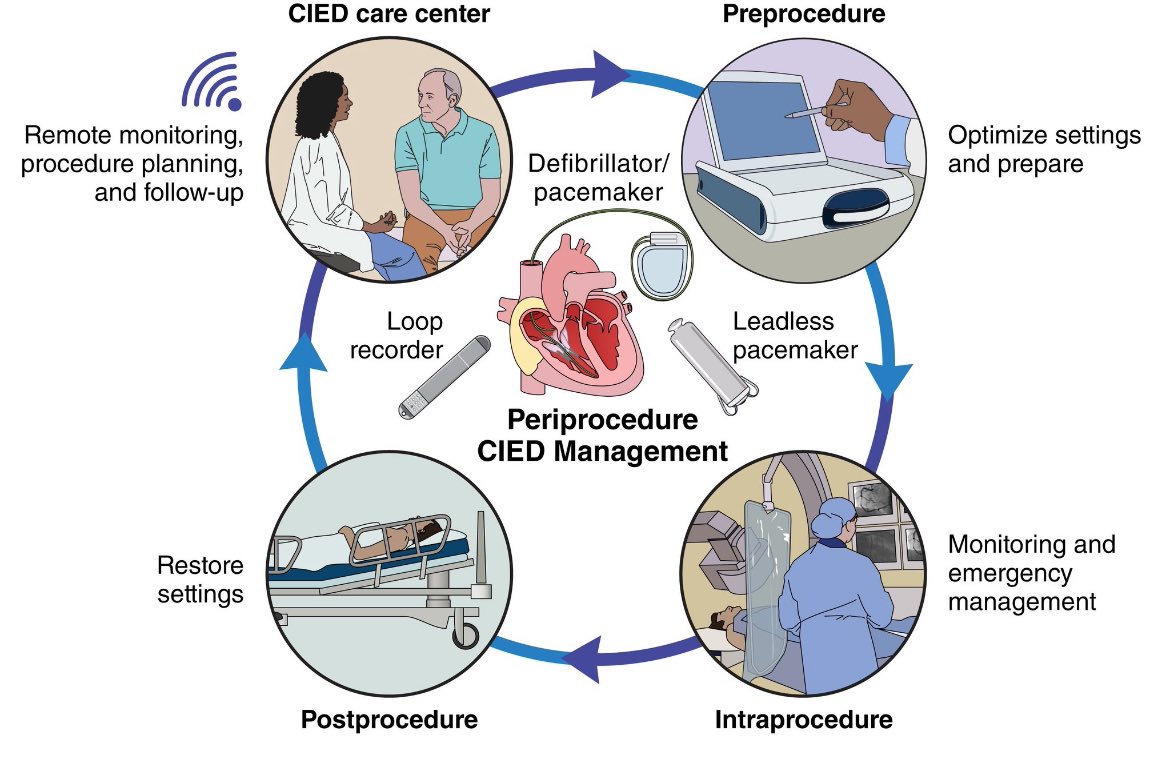Elaine Wan (@elainewanmd) on Twitter photo Thank you to <a href="/AHAScience/">AHA Science</a> <a href="/CircAHA/">Circulation</a> to allow <a href="/ajrogers_md/">A.J. Rogers</a> and I to provide new insight into periprocedural management of #leadless and #CIED devices. Dedicated to my #EPeeps, #cardiotwitter #EPNPs #PAs who reprogram or explain what is on the CXR. spr.ly/60199csfh Thank you to <a href="/AHAScience/">AHA Science</a> <a href="/CircAHA/">Circulation</a> to allow <a href="/ajrogers_md/">A.J. Rogers</a> and I to provide new insight into periprocedural management of #leadless and #CIED devices. Dedicated to my #EPeeps, #cardiotwitter #EPNPs #PAs who reprogram or explain what is on the CXR. spr.ly/60199csfh