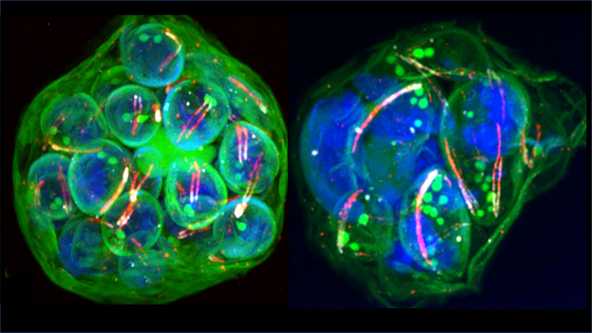 Leann Tilley (@leanntilley) on Twitter photo Yay! Our study of malaria parasite kinetochore proteins is now published in <a href="/NatureComms/">Nature Communications</a>. Jiahong and friends tagged different component of the mitotic apparatus and viewed with Ultra-Expansion Microscopy and multi-section Electron Microscopy. How cool! rdcu.be/dNlcj Yay! Our study of malaria parasite kinetochore proteins is now published in <a href="/NatureComms/">Nature Communications</a>. Jiahong and friends tagged different component of the mitotic apparatus and viewed with Ultra-Expansion Microscopy and multi-section Electron Microscopy. How cool! rdcu.be/dNlcj