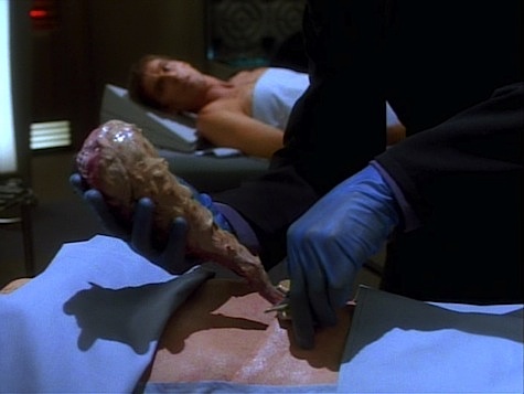 fmfagan's tweet photo. A pretty decent DS9 episode. 

Season 2, Episode 4
First aired: October 17, 1993
Teleplay by: John Whelpley and Robert Hewitt Wolfe
Story by: John Whelpley
Directed by: Les Landau
Stardate: 47182.1 (2370)

#AllStarTrek #DS9 #InvasiveProcedures https://t.co/8E1qNjaWbG