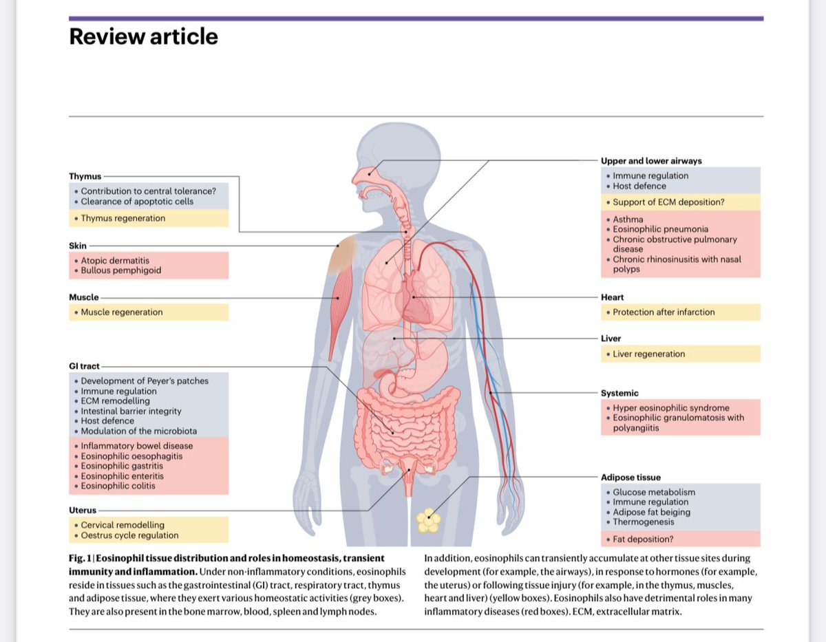 Arnold_lab (@lab_arnold) on Twitter photo OUT NOW! Your must-read #review on #eosinophils and their crucial roles in homeostasis, infection and disease. 🌋🔬 nature.com/articles/s4157…
<a href="/ArielMunitz/">Ariel Munitz</a> <a href="/Arnoldwallen/">Isabelle arnold w</a> <a href="/NatRevImmunol/">Nature Rev Immunol</a> #NatureReview #immunology OUT NOW! Your must-read #review on #eosinophils and their crucial roles in homeostasis, infection and disease. 🌋🔬 nature.com/articles/s4157…
<a href="/ArielMunitz/">Ariel Munitz</a> <a href="/Arnoldwallen/">Isabelle arnold w</a> <a href="/NatRevImmunol/">Nature Rev Immunol</a> #NatureReview #immunology